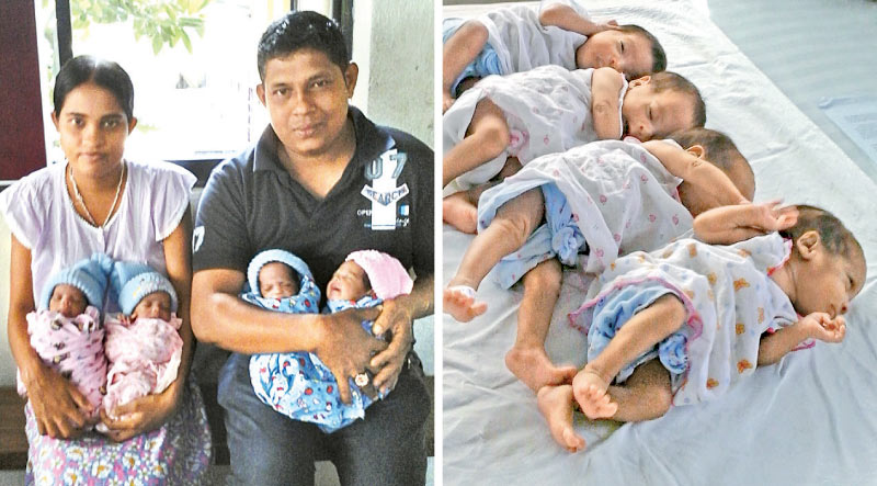 Quadruplets Born At Anuradhapura | Daily News