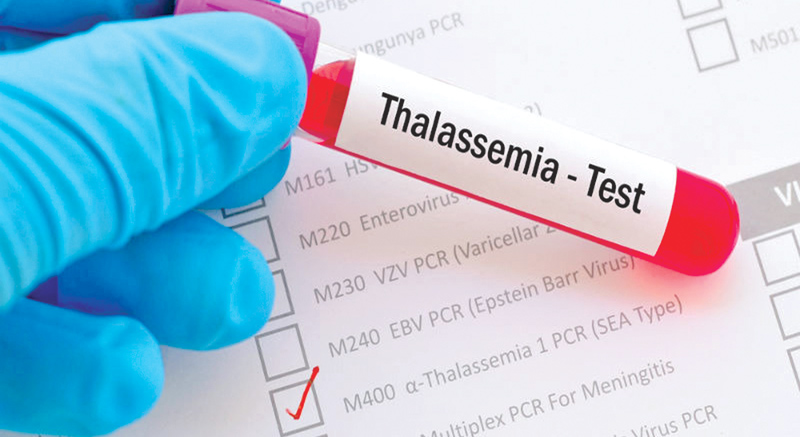 International Thalassaemia Day events in Kandy today | Daily News