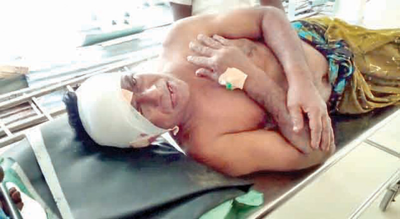 Three-wheeler driver Sumathipala (60) of Hewelwela, Bibile, was stabbed in the head several times. Picture by Prasanna Paththmasiri 