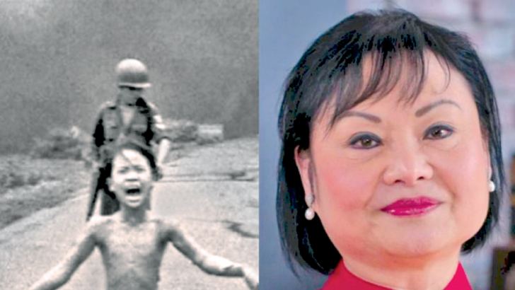 Vietnam's 'Napalm Girl' receives final skin treatment after 50 years ...