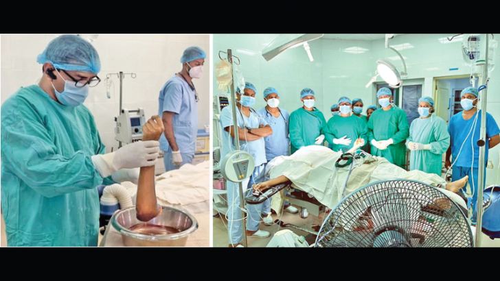 The severed hand examined by surgeon Dr. Ananda Jayawardena. Pictures by Oswald Godakumbura